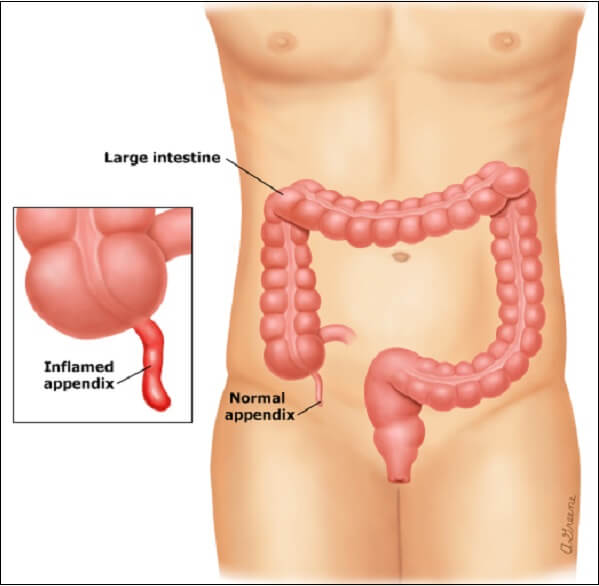 1. Định nghĩa và vai trò của ruột thừa