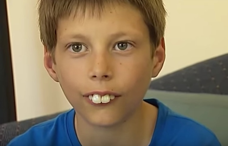 Ngữ cảnh sử dụng từ crooked teeth là gì?
