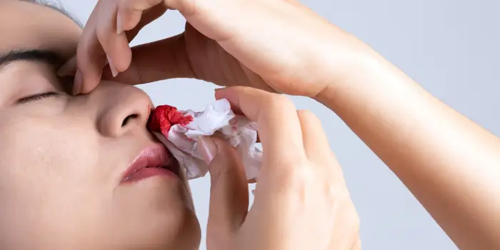 Bị chảy máu mũi có phải là triệu chứng của một bệnh nào đó không?
