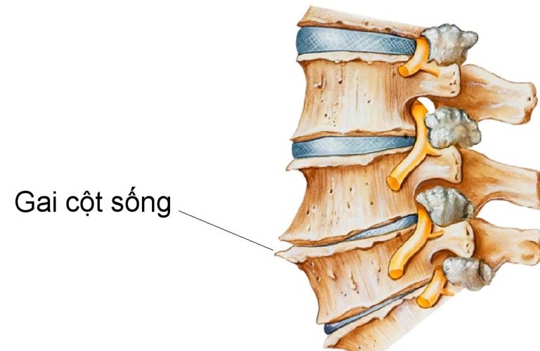 6. Giải Thích Câu Tục Ngữ: 