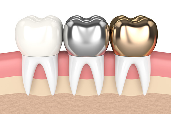 Răng sứ tiếng Anh có thể thay thế răng thật một cách tự nhiên không?
